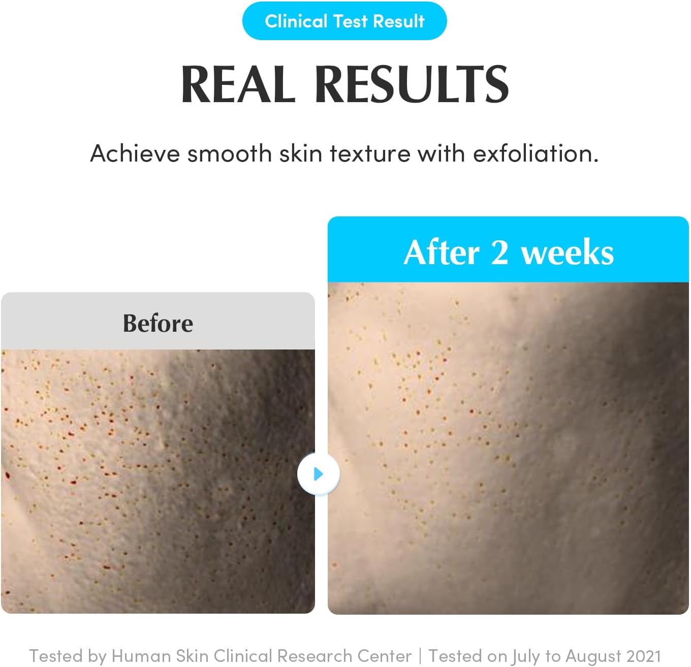 Eqqualberry – Swimming Pool Daily Facial Toner - veido tonikas