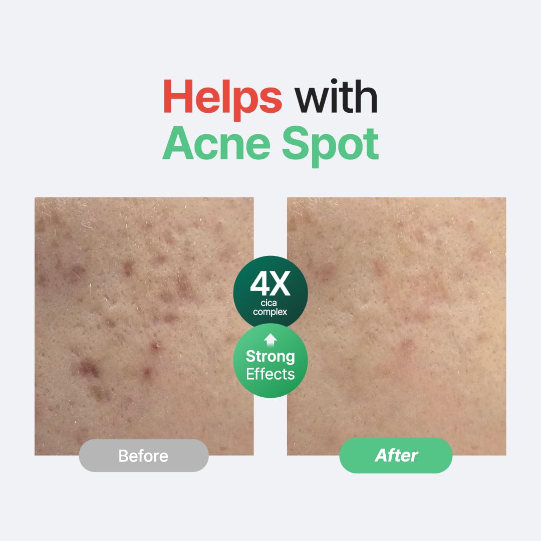 PURITO – Wonder Releaf Centella Serum Unscented - veido serumas