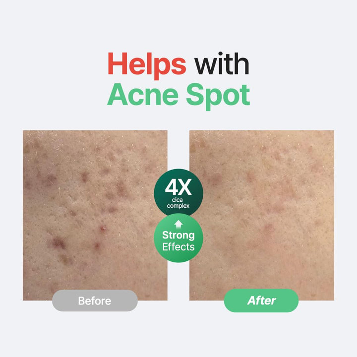 PURITO – Wonder Releaf Centella Serum Unscented - veido serumas