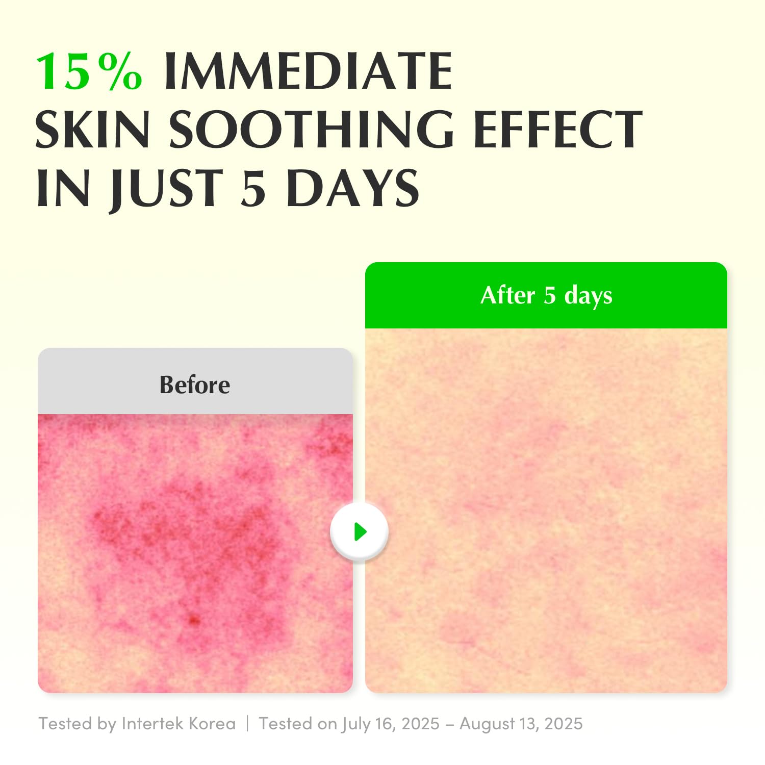 Eqqualberry – Aloe PDRN Serum - veido serumas