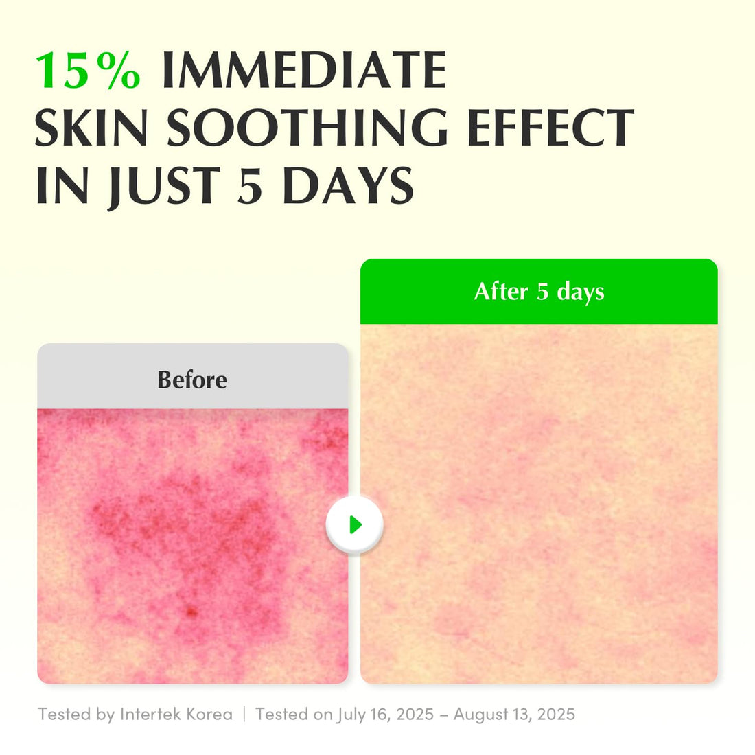Eqqualberry – Aloe PDRN Serum - veido serumas