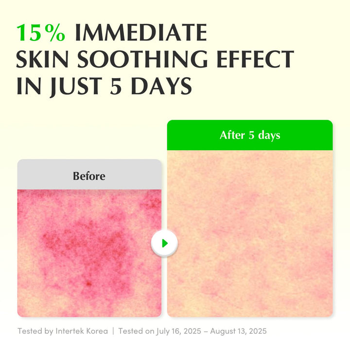 Eqqualberry – Aloe PDRN Serum - veido serumas