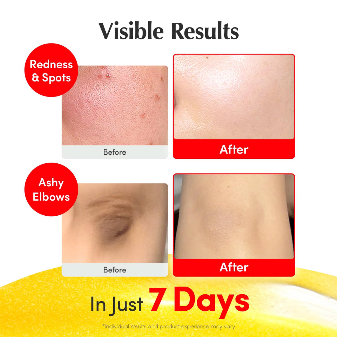 Eqqualberry – Vitamin Illuminating Serum - veido serumas