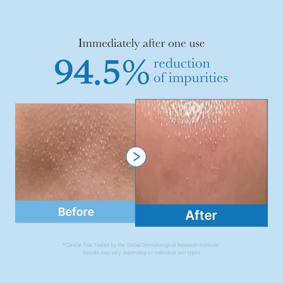 Medicube – Zero Pore Blackhead Deep Cleansing - aliejinis veido prausiklis
