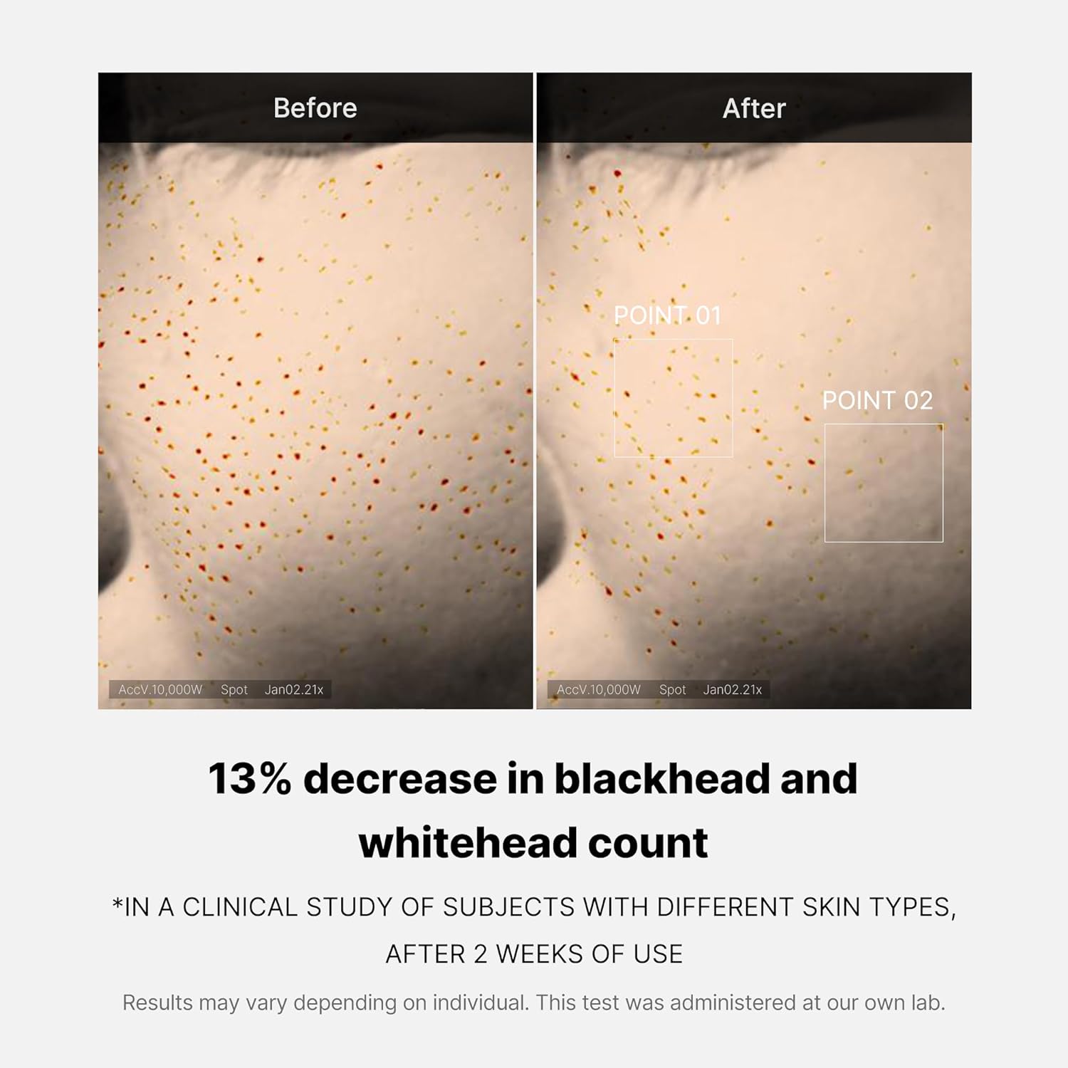 Medicube – Zero Pore One Day Serum - veido serumas su AHA, BHA ir PHA